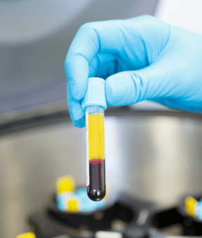 Image of vial containing blood and plasma